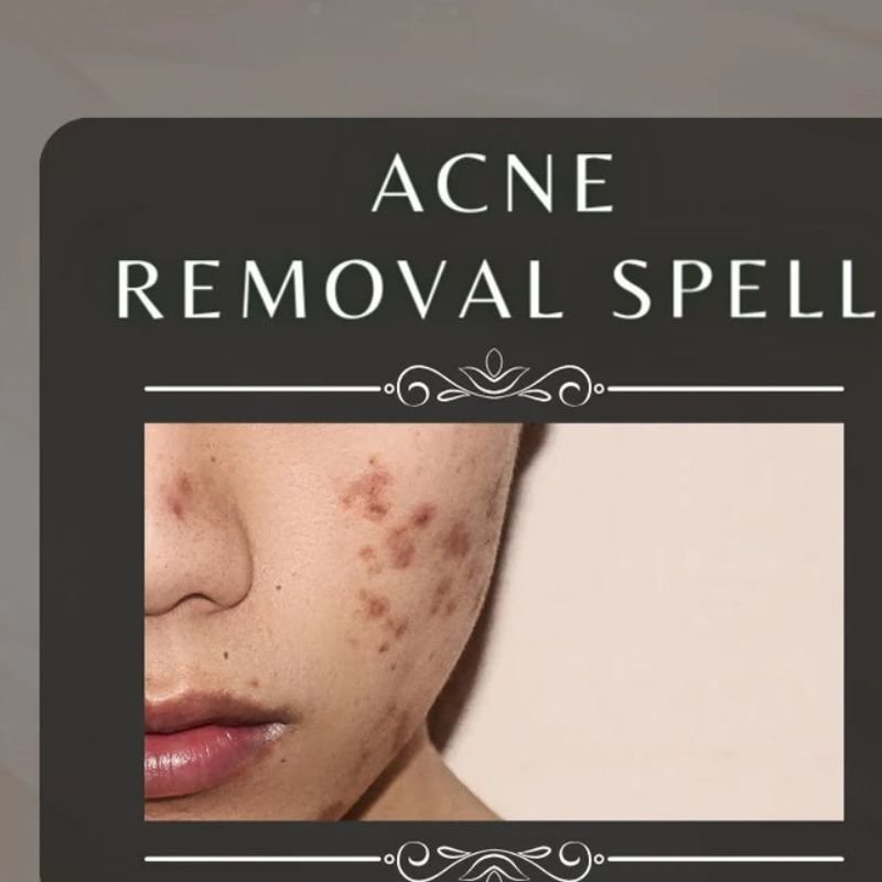Acne Removal Spell
