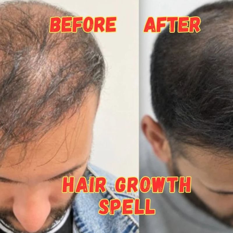 Fast Hair Growth Spell